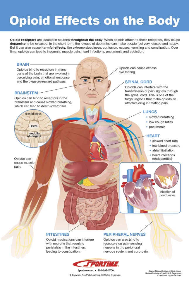 Sportime All About Opioid Drugs Bulletin Board Charts, Set Of 7, Grades 5 To 12 - Image 4