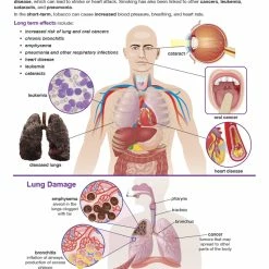 Sportime Effects Of Smoking And Vaping Bulletin Board Charts, Set Of 6, Grades 5 To 12 -Champion Sports Sales Store 2041472 E ecommfullsize