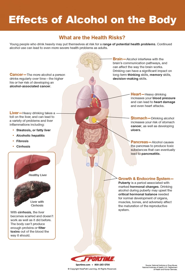 Sportime Alcohol Abuse And Addiction Bulletin Board Charts, Set Of 7, Grades 5 To 12 - Image 4